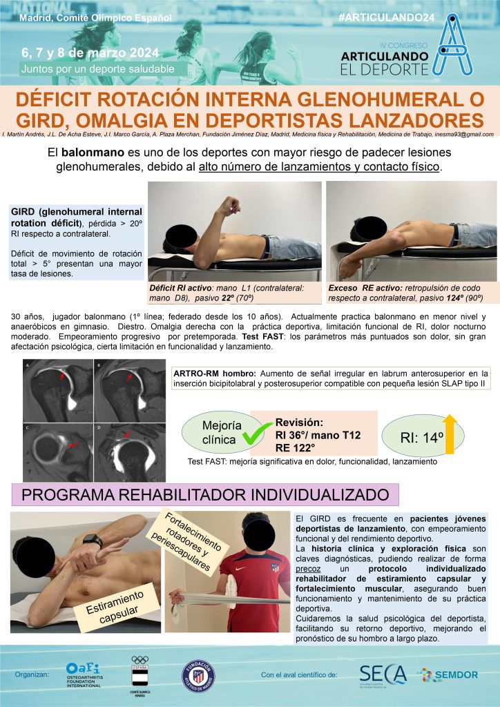 003-deficit-rotacion-interna