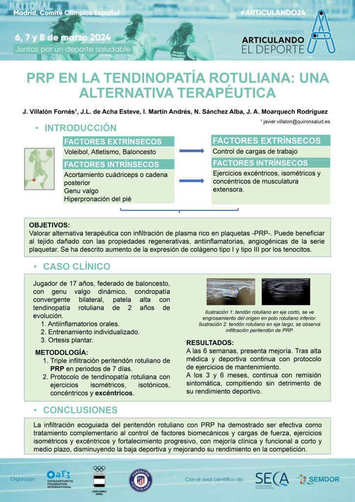 013-prp-tendinopatia