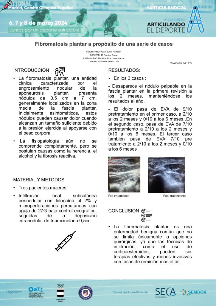 014-fibromatosis-plantar