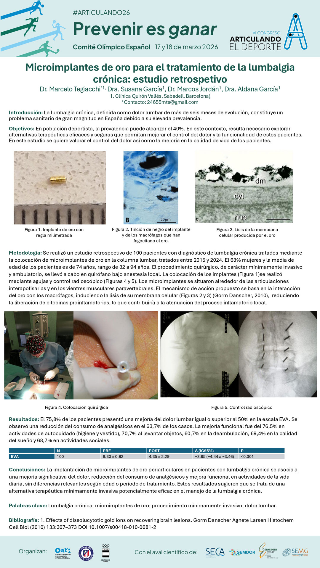 a108-microimplantes-oro